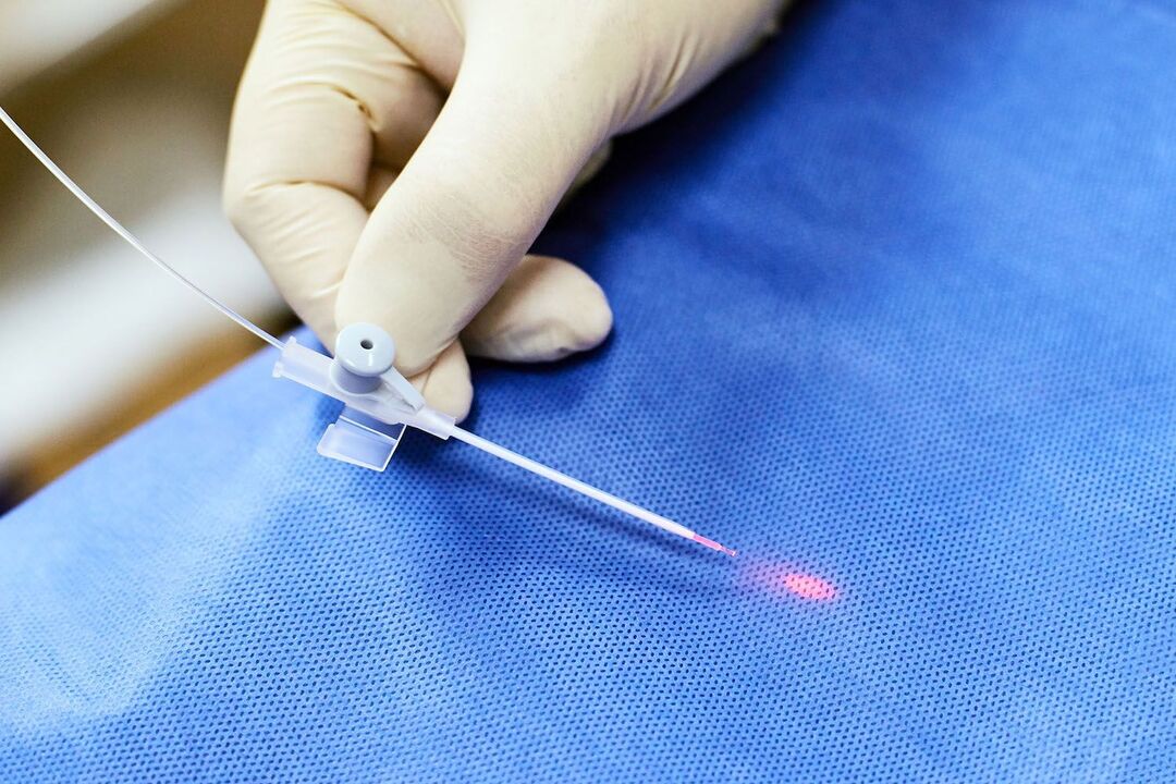transrektalna naprava za zdravljenje prostate
