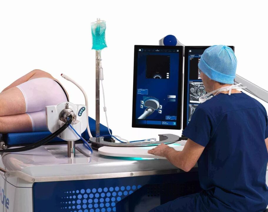 Ultrazvočni pregled prostate